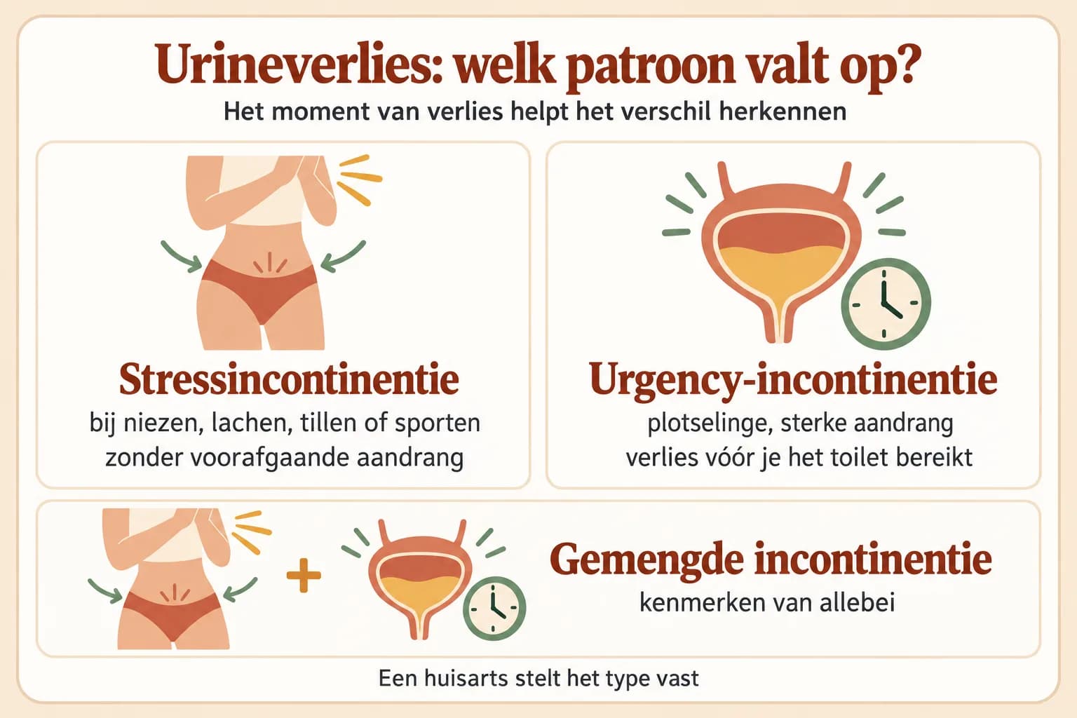 Uitlegillustratie die urineverlies bij druk, urineverlies bij plotselinge aandrang en een combinatie van beide patronen naast elkaar zet.