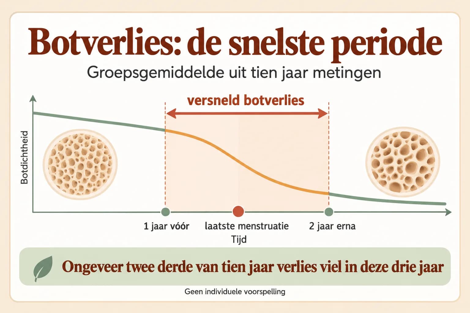 Uitlegillustratie van het versnelde botverlies rond de laatste menstruatie: ongeveer één jaar ervoor tot twee jaar erna, als groepsbeeld uit de SWAN-studie.